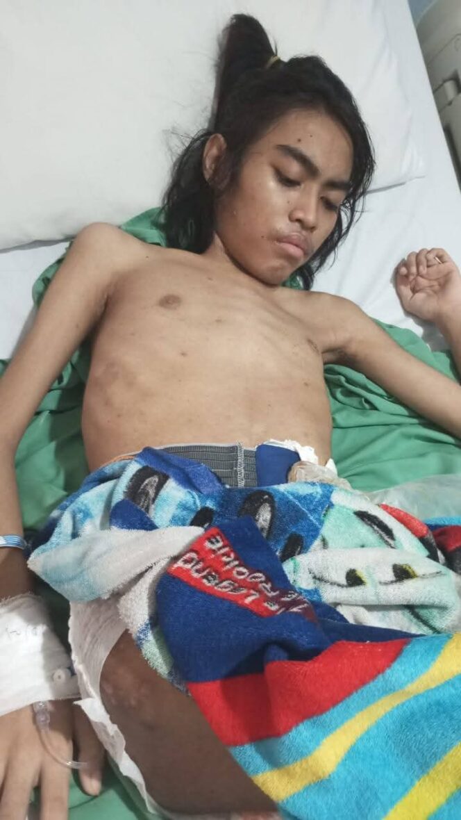
 Pemuda Miskin Penderita Tumor Usus di Lobar Butuh Uluran Tangan, Dinsos dan Kades Berkolaborasi